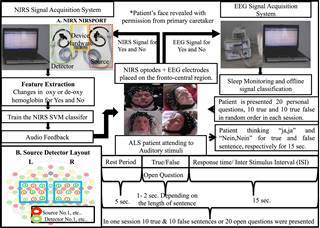 IMage: Brain-computer interface for communication in ALS patients IMage: Brain-computer interface for communication in ALS patients